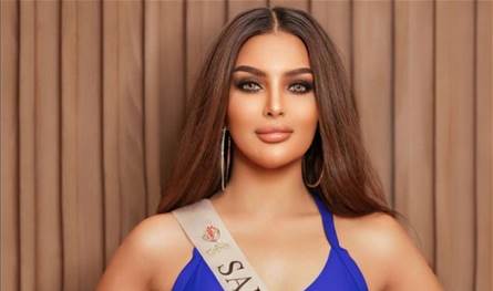 إلى جانب الشق بين حاجبيها.. ملكة جمال السعودية رومي القحطاني تكشف تشوّها جديداً في وجهها (صور)